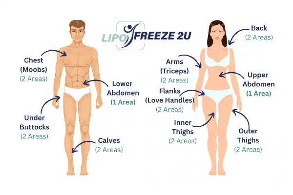 Areas you can have fat freezing treatment Corby