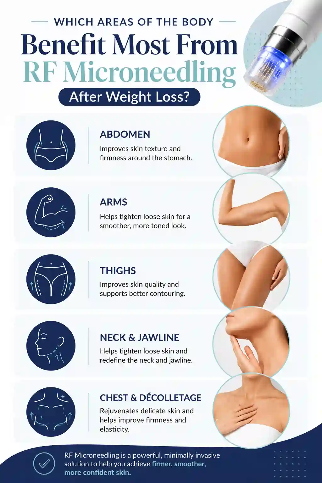 Which Areas of the Body Benefit Most From RF Microneedling After Weight Loss Corby